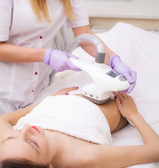 A woman receiving a CoolSculpting treatment on her abdomen by a medical professional wearing purple gloves.