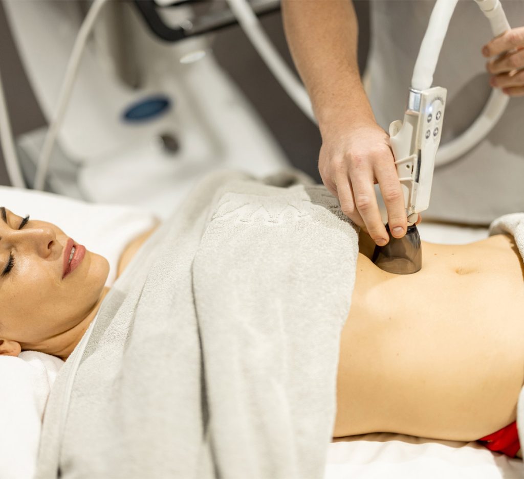 A woman lying down with a towel covering her chest while a technician uses a CoolSculpting applicator on her abdomen in a clinical setting.