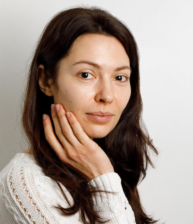 Before treatment photo showing skin concerns at Dr. Thaj Clinic